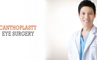 Phẫu thuật cắt mí mắt Canthoplasty Hàn Quốc