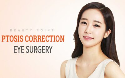 Phẫu thuật mắt chỉnh sửa Ptosis Hàn Quốc