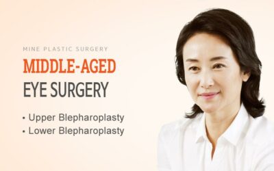 Phẫu thuật tạo hình mí mắt dưới & mí trên Hàn Quốc