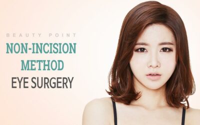 Phẫu thuật tạo mắt hai mí không phẫu thuật Hàn Quốc