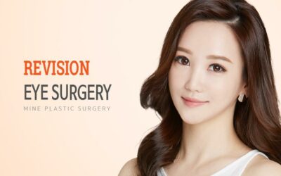 Phòng khám phẫu thuật mắt Revision Hàn Quốc